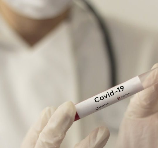 Covid-19: 1.374 décès et plus de 30.000 cas enregistrés en Afrique