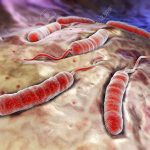 image cholera